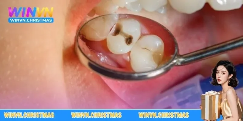 Mơ mất răng sâu